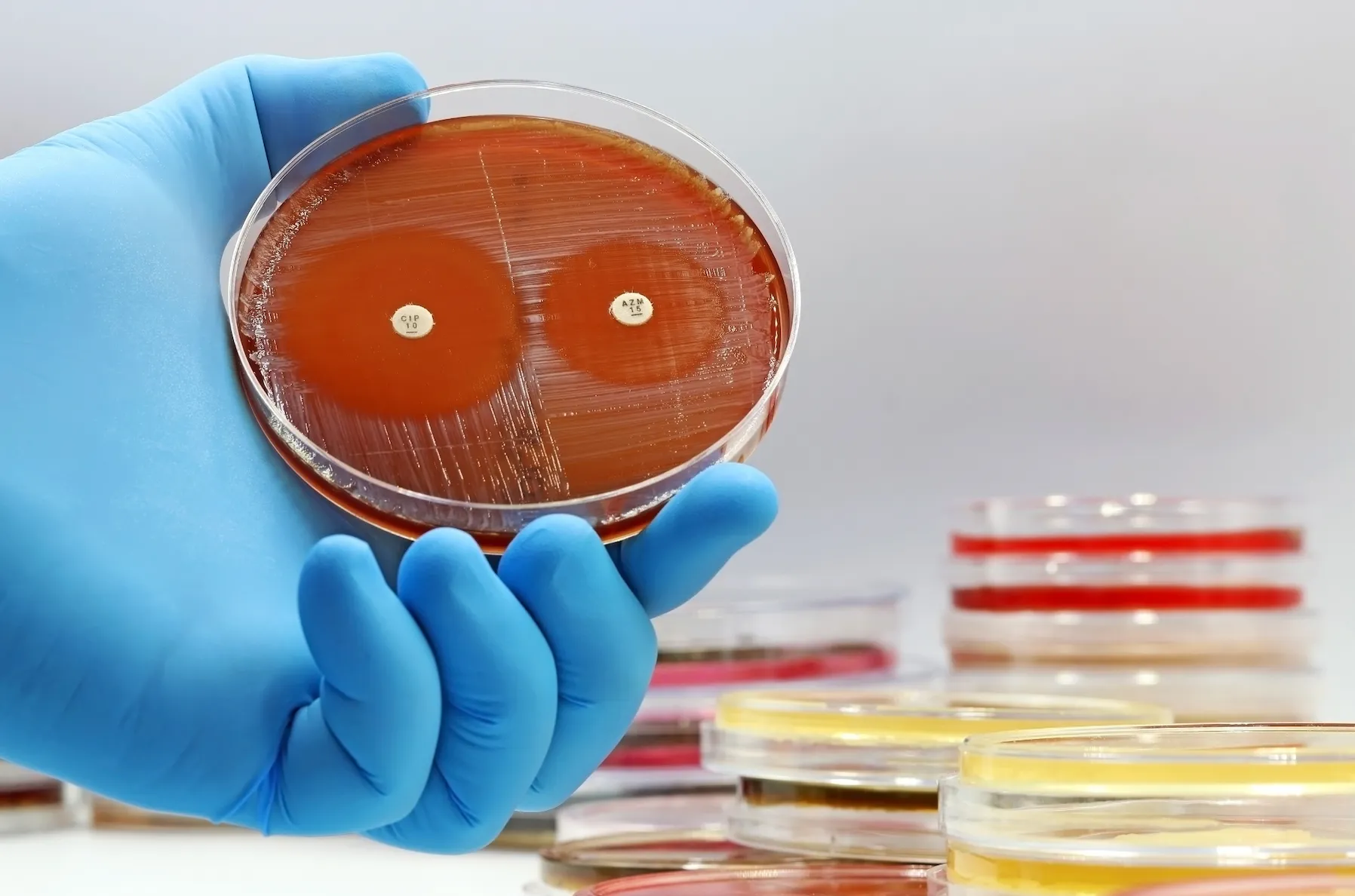 Antibiotic resistant bacteria like staphylococcus aureus requires modern medicine and prescription antibiotics to treat it. 